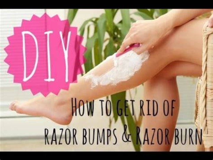 A Top Barber Explains How to Prevent and Treat Razor Burn