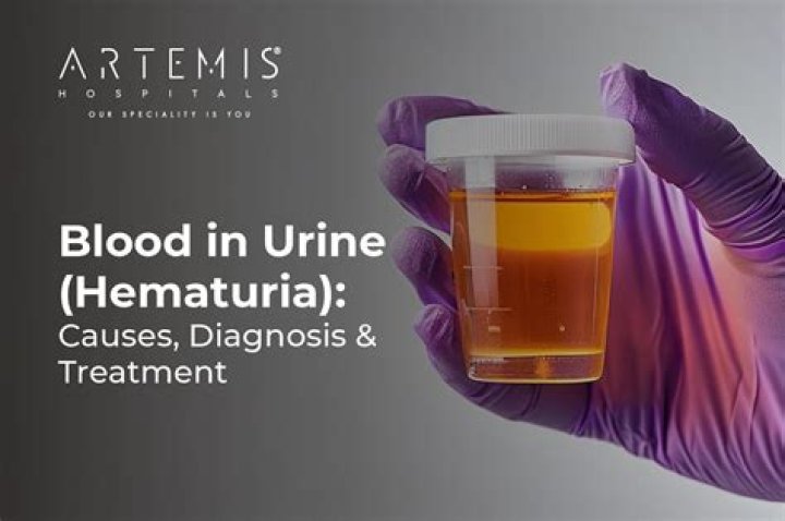 Can a Hernia Cause Blood in Urine
