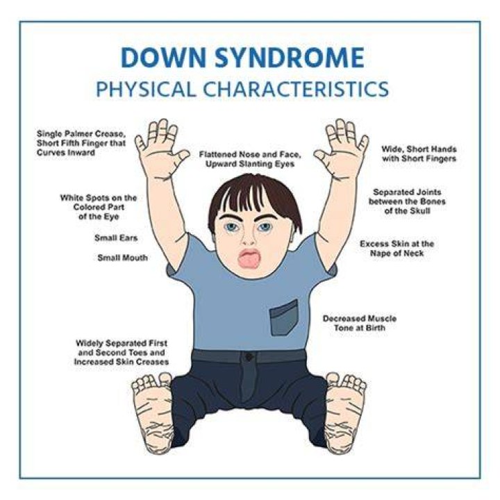 Does Crew Have Down Syndrome? A Comprehensive Analysis