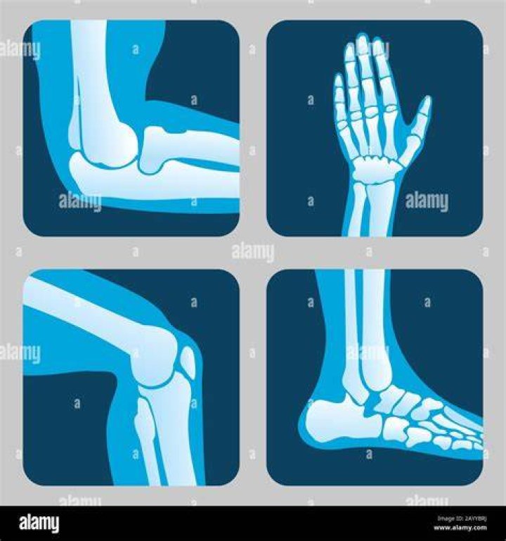 leg, human leg, wrist, elbow, joint, exercise, knee, physical fitness, thigh, sports,