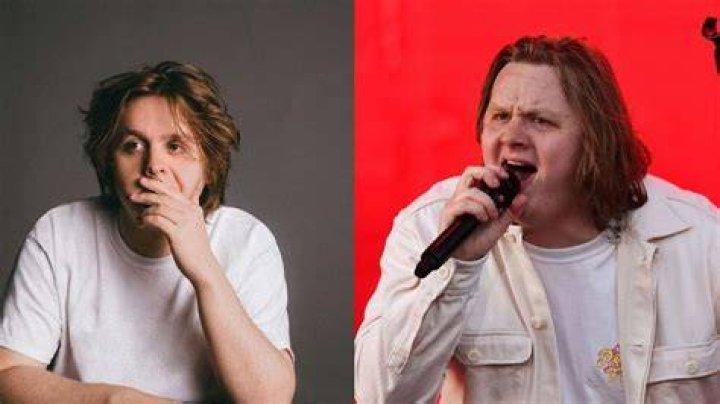 Lewis Capaldi Weight Gain How Did He So fat?