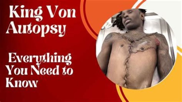 Understanding Ling Von Autopsy: A Comprehensive Guide