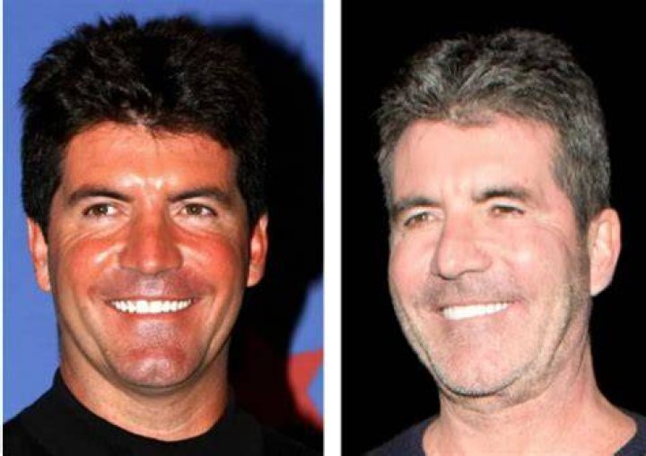 Understanding Simon Cowell's Journey With His Disabled Son