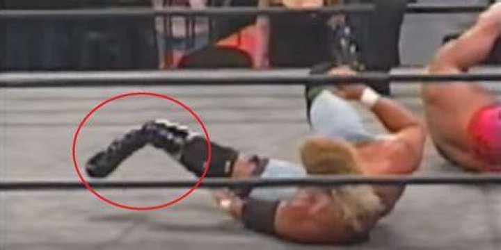 Worst WWE Injuries